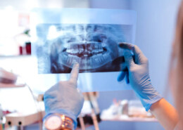 Why Regular Dental X-Rays Are Important Even if Teeth Look Fine!