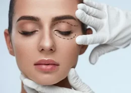 Top-Rated Plexr Plasma Eye Lift Abu Dhabi | Glamorous Clinic in Dubai