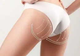 Brazilian Butt Lift for Balanced Body Shape Dubai & Abu Dhabi | Glamorous Clinic in Dubai