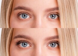 5 Ways to Stop Redness After a Professional Waxing Service