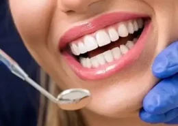 E-Max Veneers in Dubai & Abu Dhabi for Damaged Teeth | Glamorous Clinic Dubai