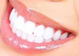 Teeth Whitening for a Confident Smile in Dubai | Glamorous Clinic Dubai