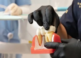 Dental Implants Dubai & Abu Dhabi for Better Oral Function | Glamorous Clinic Dubai