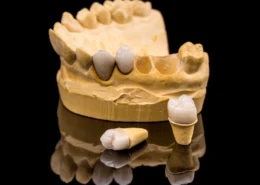 Zirconia Crown Dubai & Abu Dhabi for Customized Dental Crowns | Glamorous Clinic Dubai
