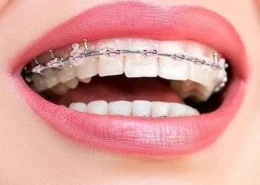 Advanced Jaw and Facial Development Solutions | Glamorous Clinic Dubai