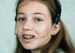Orthodontic Headgear for Bite Correction | Glamorous Clinic Dubai
