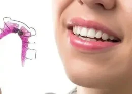 Fixed Appliances for Gaps Between Teeth | Glamorous Clinic Dubai