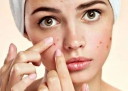 Acne Treatment for Persistent Breakouts in Dubai & Sharjah | Glamorous Clinic Dubai